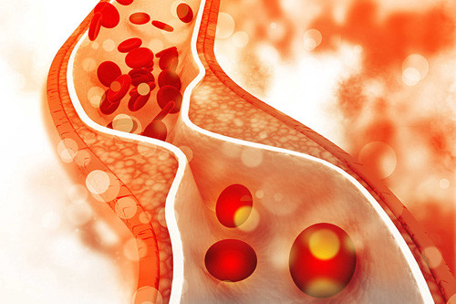 Cholesterol là chất béo có trong máu, đảm nhận vai trò tạo lớp màng cho các tế bào. Cholesterol có 3 loại là cholesterol HDL, cholesterol LDL và chất béo triglyceride. Trong số đó, cholesterol HDL được đánh giá là tốt vì giúp giảm chất béo dư thừa bằng cách chuyển chúng từ hệ thống động mạch tới gan để xử lý và thải ra ngoài. (Ảnh minh họa)