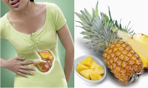 Khi bị đau dày. Quả dứa có nhiều axít hữu cơ và có một số enzyme có tác dụng làm tiêu protein, làm tăng viêm loét niêm mạc dạ dày. Vì vậy, dứa không có lợi cho người đau dạ dày. Ảnh: apexpharma