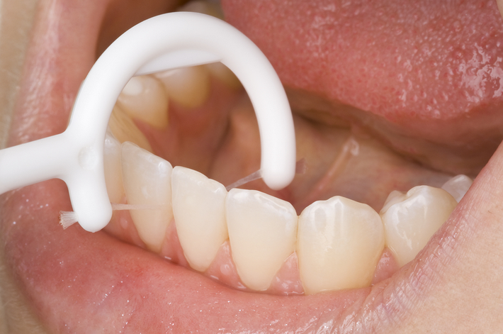 Vì vậy, nếu bạn không chắc chắn về cách vệ sinh, chăm sóc răng miệng đúng cách với chỉ nha khoa, sau đây sẽ là hướng dẫn giúp bạn dùng chỉ nha khoa. Ảnh: dentagama.
