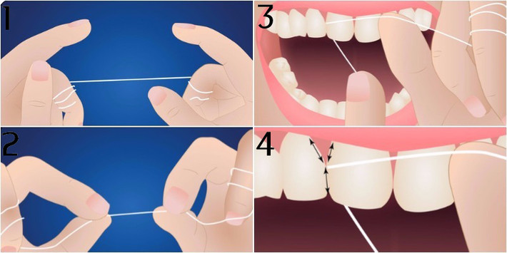 Do đó, bạn nên chọn loại chỉ nhỏ, mềm và mịn để tránh tổn thương men răng. Ảnh: nhakhoathutrang.