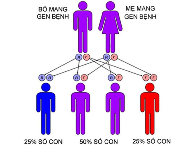 Bệnh di truyền là gì? Bệnh di truyền hay cụ thể hơn là các bệnh di truyền ở người xảy ra do nguyên nhân từ những bất thường về gen hoặc nhiễm sắc thể. Bệnh di truyền là những bệnh do bố mẹ truyền sang cho con cái do những bất thường về gen. Bệnh về nhiễm sắc thể (NST) là bệnh được gây ra do mất NST, bất thường hoặc thừa NST.
