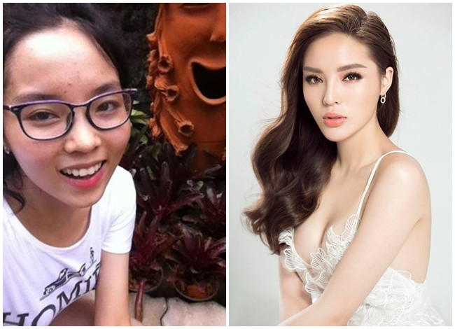 Hoa hậu Kỳ Duyên được nhận xét là "dậy thì thành công" nhất trong số các Hoa hậu Việt Nam. Thuở học sinh, cô nàng có làn da bánh mật cùng gương mặt lấm tấm mụn. Ngoài gương mặt khác lạ với chiếc cằm ngày càng nhọn, mới đây, người đẹp Nam Định còn vướng nghi vấn dao kéo vòng một vì quá sexy.