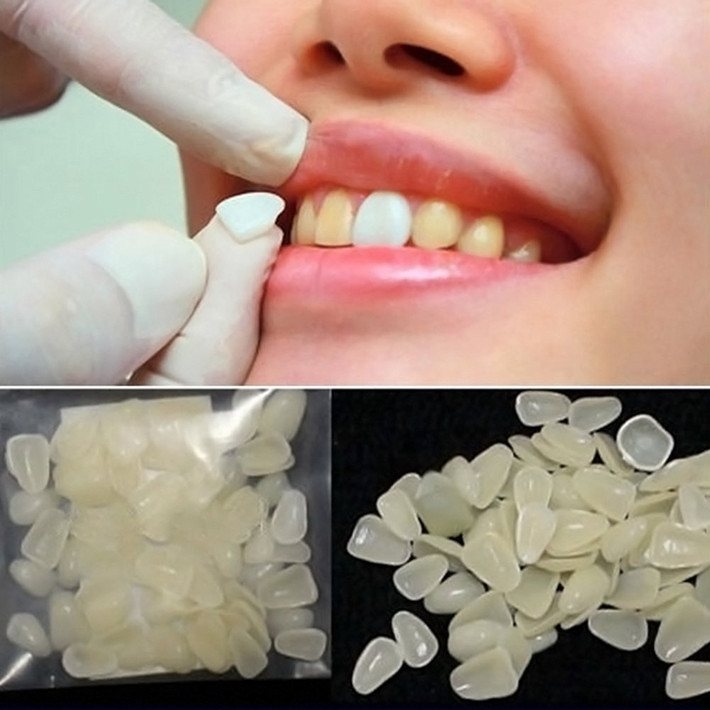 Do mặt dán Veneer cũng cần vệ sinh như răng thật nên bạn cần đánh răng, dùng chỉ nha khoa hàng ngày để làm sạch vụn thức ăn bám trên răng. Ảnh: amazon.