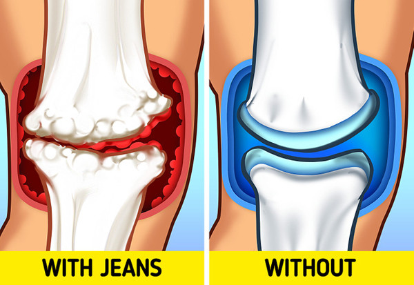 Gây đau chân. Những mẫu quần jeans bó sát tôn dáng, dễ phối đồ được chị em ưu ái. Vậy nhưng để tốt cho sức khỏe, bạn không nên mặc chúng trong thời gian dài, nên cởi bỏ ngay khi về đến nhà. (Ảnh minh họa, Brightside)