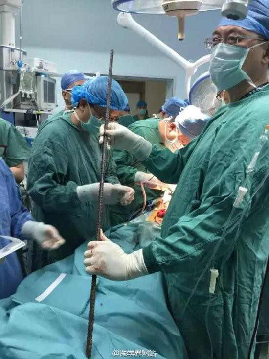 Bác sĩ Sang Xiguang, trưởng khoa phẫu thuật khẩn cấp Bệnh viện Đại học Qilu, Sơn Đông, Tế Nam cho biết đây là một tai nạn nguy hiểm và cực kỳ hiếm.