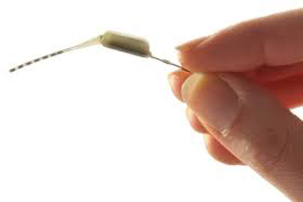 Thiết bị neuromodulation chữa những cơn nhức đầu. Nếu bạn đã từng bị đau đầu khủng khiếp và phải gọi bác sĩ, thì nay đã không cần lo lắng vì đã có thiết bị hiện đại này. Nó được cấy vào vị trí trên xương hàm và được kích hoạt bằng một thiết bị điều khiển từ xa.