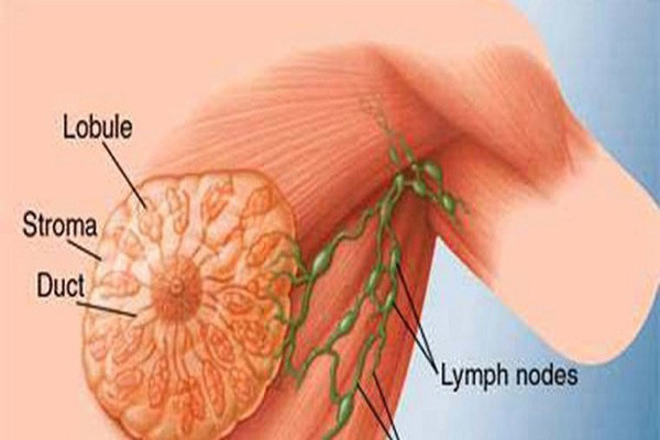Chụp nhũ ảnh 3D để phát hiện ung thư vú. Chụp nhũ ảnh là xét nghiệm X-quang căn bản cho phép phân tích cấu trúc tuyến vú để tìm ra những thay đổi trong cấu trúc của vú mà khám tay không thấy được... Một số ung thư có thể nhìn thấy được trên phim chụp nhũ ảnh, thậm chí ngay cả trước khi có các triệu chứng.