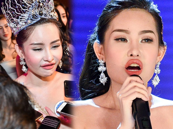 Thời điểm đăng quang Hoa hậu Đại Dương 2017, Lê Âu Ngân Anh đối mặt với làn sóng chê bai dữ dội về nhan sắc không tự nhiên. Ảnh: Tintucvietnam