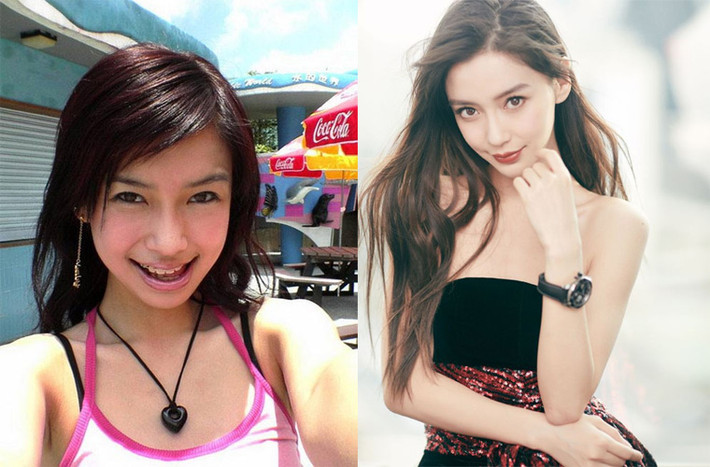 Tuy nhiên Angelababy phủ nhận chuyện thẩm mỹ mà khẳng định nhan sắc mình thay đổi như vậy là nhờ niềng răng.