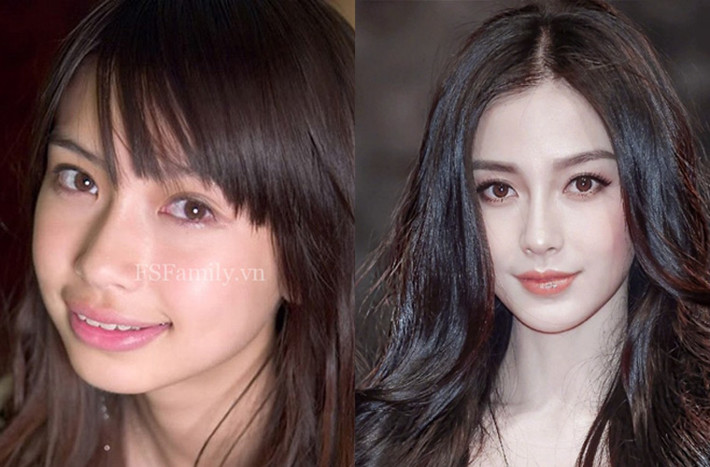 Angelababy bị nghi ngờ đã trải qua nhiều cuộc phẫu thuật thẩm mỹ để biến “vịt” thành “thiên nga”.