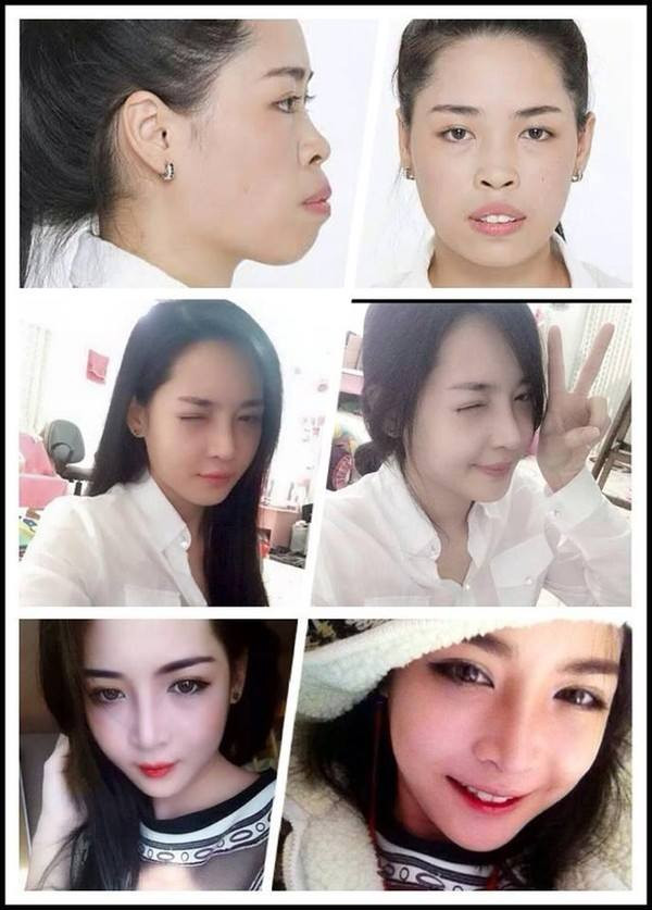 Đầu năm 2015, Quỳnh trở về Việt Nam hội tụ cùng gia đình với ngoại hình xinh đẹp.