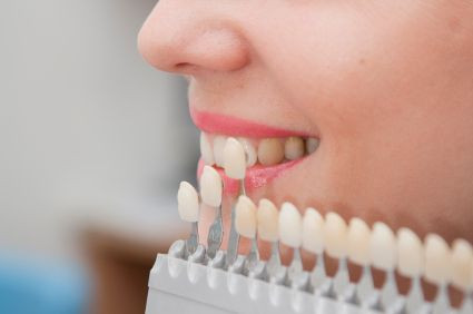 Tẩy trắng răng chỉ có kết quả rất hạn chế vì chỉ có người răng đã trắng sẵn, muốn trắng hơn nữa thì tẩy trắng răng mới đáp ứng được, còn người răng quá vàng và nhiễm sắc do tetracycline có màu nâu sậm thì tẩy răng không có kết quả.