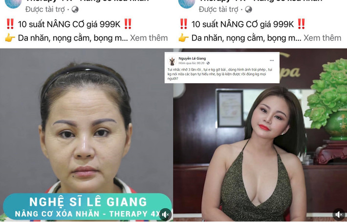 Mới đây trên trang cá nhân, nghệ sĩ hài Lê Giang không ngừng bày tỏ sự bức xúc khi những hình ảnh của mình bị một cơ sở thẩm mỹ sử dụng để quảng cáo mà không xin phép. Thậm chí trong đó, một bức ảnh mặt mộc, da nhăn nheo kém sắc của chị còn bị một số khán giả nghi là đã qua chỉnh sửa.