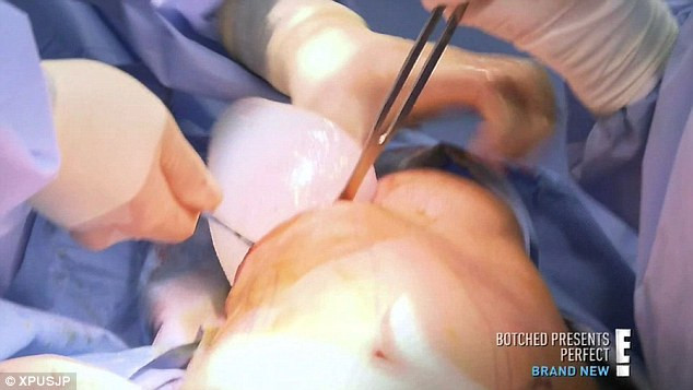 Mỗi bên bả vai sẽ được nhét 2 miếng silicone để tạo hiệu ứng "cánh thiên thần" trên cơ thể anh chàng búp bê sống này.