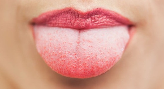 Việc thử thách ăn mì cay cấp độ cao của giới trẻ dường như đang là sự đầu độc sức khỏe của bản thân một cách từ từ. Việc ăn mì cay quá nhiều hoặc ở những cấp độ cao, lưỡi sẽ bị bỏng, rát, thậm chí có thể gây lở miệng. Bên cạnh đó, chất Capsaicin trong ớt không thể tiêu hóa được nên sẽ gây cảm giác nóng, rát ở hậu môn khi đại tiện.