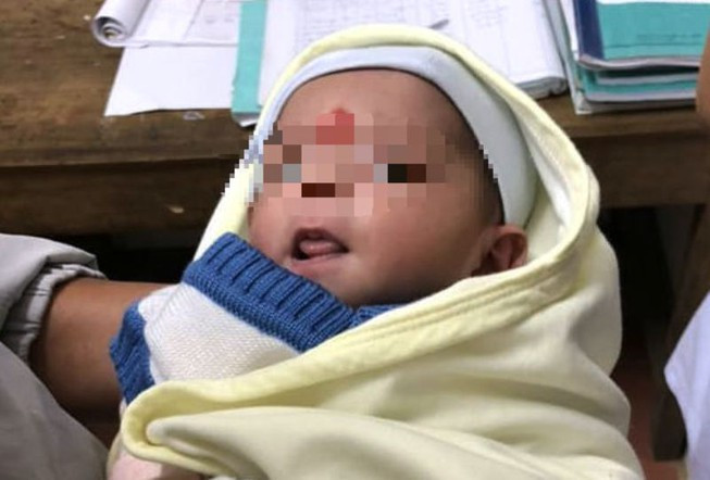 Kiến bám đầy bé sơ sinh bị bỏ rơi ở cạnh chùa: Sáng 18/7, người dân đi đường phát hiện một bé gái sơ sinh bị người thân bỏ rơi gần chùa Sơn Nguyên ở thị trấn A Lưới ((huyện A Lưới, Thừa Thiên - Huế). Lúc này, bé gái được quấn tạm trong chiếc khăn và bị kiến bám đầy người, sức khỏe yếu. Ngay sau đó, bé được người dân đưa về nhà gần đó để sơ cứu ban đầu và trình báo cơ quan chức năng. Hiện tại sức khỏe của bé đã tốt hơn.