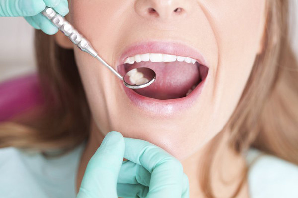 3. Bệnh răng miệng: Mắc các bệnh răng miệng như viêm lợi, viêm chân răng, viêm nướu,... người bệnh khi ngủ dậy sẽ có cảm giác khô miệng, hơi thở có mùi hôi.