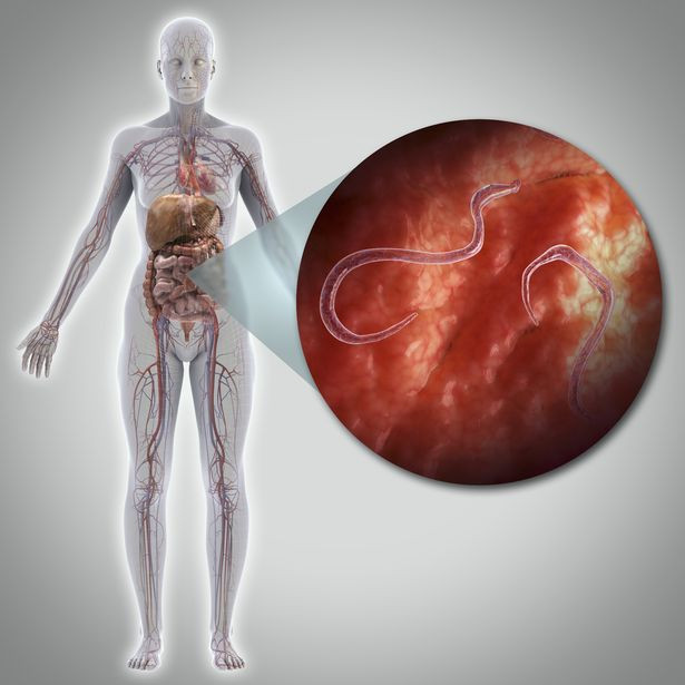 Vi khuẩn Clostridium novyi (C. novyi) tiêu diệt ung thư. C. novyi là loại vi khuẩn sống trong đất, là nguyên nhân chính gây nhiễm trùng và tổn hại mô khi chúng xâm nhập vào cơ thể. Hiện nay, các nhà khoa học đã bắt đầu sử dụng vi khuẩn C. novyi để giết chết tế bào ung thư.