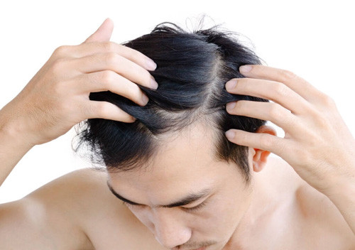 Rụng tóc nhiều cũng là dấu hiệu cho thấy quá trình lão hóa đang diễn ra. Một người khỏe mạnh có thể rụng 100 sợi tóc mỗi ngày. Ngược lại nếu rụng quá 100 sợi, diễn ra trong thời gian ngắn thì đây là dấu hiệu của lão hóa.