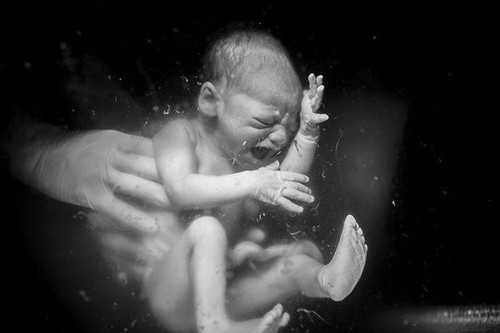 1. Em bé chiều cao “khủng” nhất. Ca sinh nở kỳ lạ với em bé có kích thước dài nhất thế giới thuộc về bà mẹ Anna Bates. Kỷ lục Guinness Thế giới ghi nhận sự kiện thách thức trí tưởng tượng này xảy ra tháng 1/1987. Em bé Babe sinh ra với chiều dài toàn thân là 71,12cm, nặng 10kg. Kích thước của bé được thừa hưởng từ chiều cao “khủng” của cả bố lẫn mẹ (Mẹ cao 2m41, bố cao 2m36). Điều đáng tiếc Babe quá yểu mệnh, qua đời chỉ sau 11 giờ được sinh ra. (Ảnh: Livescience, minh họa)