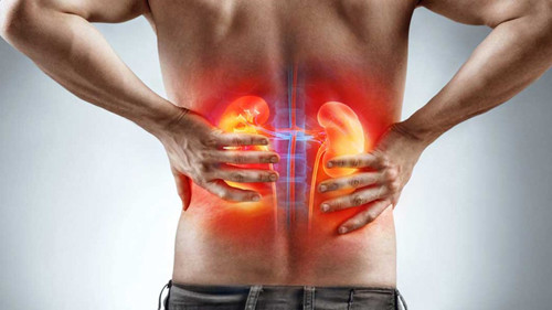 Bên cạnh đó, nhịn tiểu khiến chất thải không được đẩy ra ngoài kịp thời, dẫn tới nước tiểu cô đặc, kết tinh làm tăng nguy cơ sỏi đường tiết niệu, tiểu ra máu. Người bệnh sẽ có các triệu chứng như đau nhức, đau quặn, đau từ lưng xuống bụng dưới. Sỏi càng to càng dễ gây phù thận, niệu quản và tổn thương thận cấp.