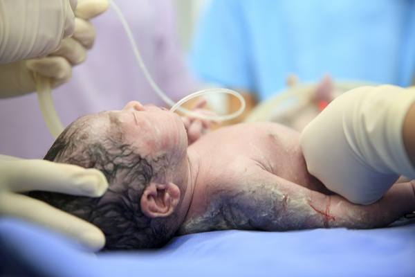 Nhiều bệnh viện khác gần đây cũng đã áp dụng quy trình trì hoãn kẹp cắt dây rốn như Bệnh viện Liverpool. Đây là bệnh viện phụ sản lớn nhất của Vương quốc Anh với 8.100 ca sinh mỗi năm, đã áp dụng phương pháp này từ nhiều năm trước. Cụ thể, bệnh viện này đã áp dụng trì hoãn cắt rốn một phút cho trẻ sơ sinh đủ tuần, 30 giây cho trẻ sinh non và trẻ cần được chăm sóc đặc biệt.