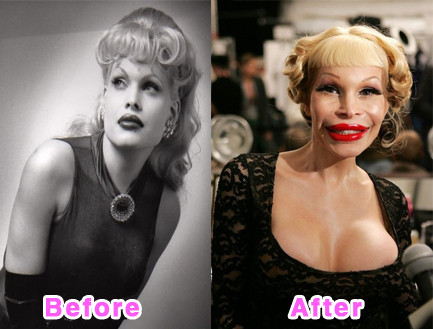 Amanda Lepore từng được ca ngợi là một trong những người mẫu chuyển giới xinh đẹp nhất thập niên 80, 90.