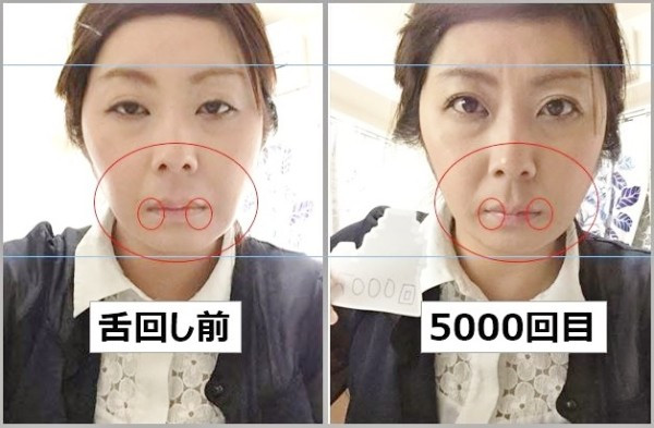 Đến 5.000 lần, gò má căng tròn nhưng khuôn mặt vẫn rất thon gọn.