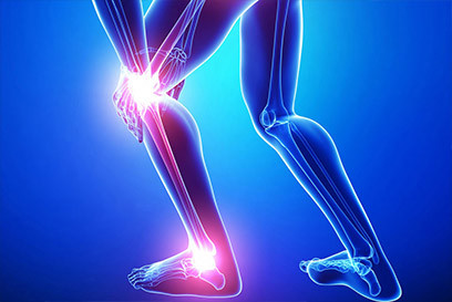 Nếu bị đau khớp, bạn có thể bổ sung thêm nhiều chất có tác dụng nuôi dưỡng sụn khớp như glucosamine và chondroitin, vitamin D (có nhiều từ ánh sáng mặt trời).