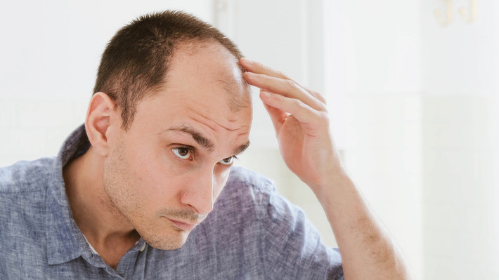 Có cách khác là trộn móng guốc động vật và bàn chân chó vụn, với nước ép quả chà là và để lại trên da đầu. Tuy nhiên, cả hai hỗn hợp trên đều không hiệu quả, và gây ra tình trạng phát ban da đầu, mùi hôi khó chịu. Ảnh: @Grunge.