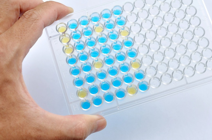 Đây là kết quả nghiên cứu của đề tài “Nghiên cứu sản xuất kít ELISA chẩn đoán bệnh thiếu men G6PD, bệnh suy giáp bẩm sinh và bệnh tăng sinh tuyến thượng thận bẩm sinh”, mã số UDSXTN.04/18-19.