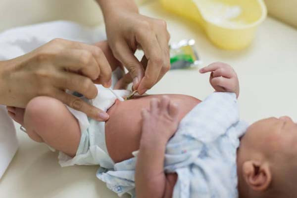 Rốn. Trước khi cuống rốn chưa rụng, tuyệt đối không dùng nước để vệ sinh. Chuyên gia y tế khuyên nên dùng tăm bông sạch nhúng cồn y tế 75% lau nhẹ rốn để sát trùng, tránh nhiễm khuẩn tại chỗ do chất bẩn trên cơ thể đọng lại.