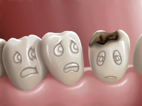 Chảy nước dãi khi ngủ thực sự đáng lo ngại khi liên quan đến các bệnh răng miệng. Nếu không chú ý vệ sinh răng miệng, lượng lớn vi khuẩn gây bệnh sẽ làm tổn thương niêm mạc miệng, sâu răng, viêm nha chu... Nếu không được điều trị, viêm miệng có thể làm tăng tiết nước bọt, dẫn đến chảy dãi khi ngủ.