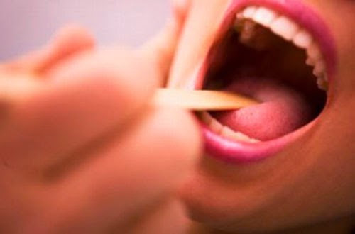 Ung thư hầu, miệng. Theo nhiều nghiên cứu khoa học cho thấy những người thường xuyên hút thuốc lá có nguy cơ mắc bệnh ung thư khoang miệng cao gấp 27 lần so với những người không hút thuốc, không tiếp xúc với môi trường có nhiều khói thuốc. Các dẫn chất trong thuốc lá và khói thuốc lá có chứa các chất thúc đẩy sự phát triển ung thư trong khoang miệng.