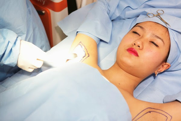 Một số ít khách hàng thực hiện tiêm botox trị hôi nách tại những cơ sở không đủ năng lực, có thể dẫn tới tình trạng nhiễm trùng, tụ máu, teo cơ…