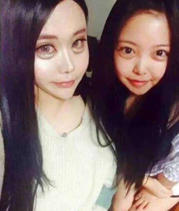 Thiếu nữ người TQ này khiến nhiều người nể sợ khi khoe hình ảnh đôi mắt “ốc nhồi” to kì lạ. Đặc biệt phần bọng mắt được cô gái này tiêm silicon lỏng khiến mắt sưng húp với mong muốn sở hữu đôi mắt của búp bê.