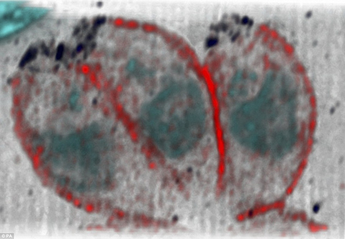 Hình ảnh vi khuẩn Toxoplasmosis - loại ký sinh trùng gây bệnh có trong thịt tái, nấu chưa chín.