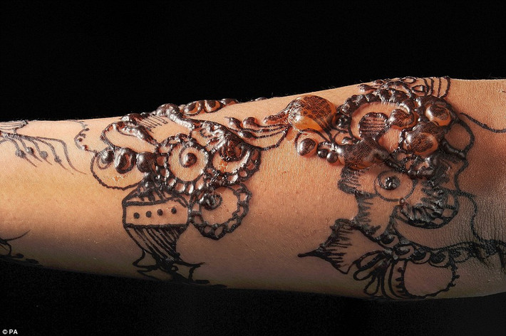 Bức ảnh này cho thấy một hình xăm henna trên cánh tay của một cô gái trẻ. Cô có mụn nước trên tay cô ấy vì cô bị dị ứng với thuốc nhuộm. Những mụn sẽ chữa lành nhưng thật đáng buồn chúng có thể để lại dấu vết trên da.