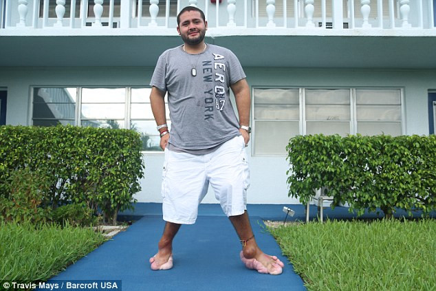 Anh Jeffrey Ortega, 26 tuổi đến từ từ Deerfield Beach, Florida, Mỹ cầu xin cắt bỏ đôi chân do mắc hội chứng Proteus, khiến các mô phát triển bất thường ở tay, hông, chân.