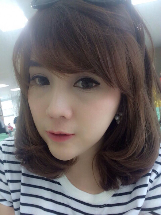 Môi vốn được coi là một trong những khu vực nhạy cảm nhất của cơ thể, chỉ cần một vết xước nhẹ cũng khó lành và đau đớn cả tuần. Vì vậy có thể hiểu cô gái đã phải chịu đau đớn đến chừng nào để cắt đi một phần môi của mình.