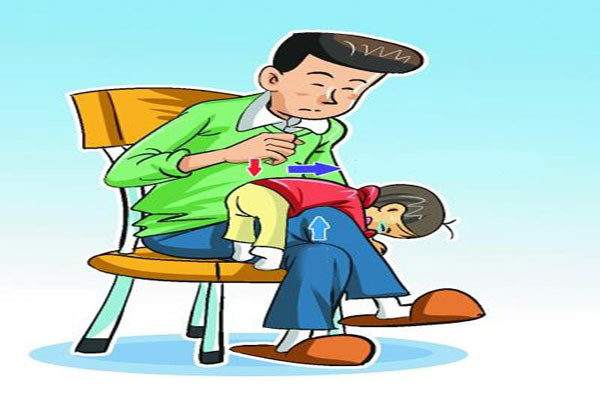 Cách 2. Người lớn ngồi trên lưng ghế, một chân vắt lên chân kia, để con nằm úp mặt, đầu gối chạm vào phần bụng của con, tiến hành vỗ lưng cho con từ dưới lên, khoảng 100 lần/phút để vật bị hóc vọt ra ngoài.