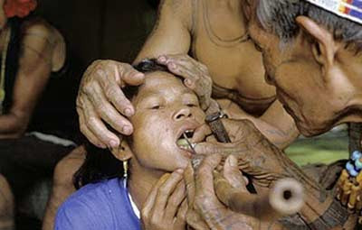 Tục đục răng của phụ nữ Mentawai. Phụ nữ của tộc người Mentawai, Indonesia cũng có cách làm đẹp rất kỳ quặc: đục răng. Họ phải chịu đựng đau đớn, buốt đến tận óc khi pháp sư địa phương dùng chiếc đục thật sắc để đục răng. May mắn là qua thời gian, hủ tục này đã dần mai một đi.