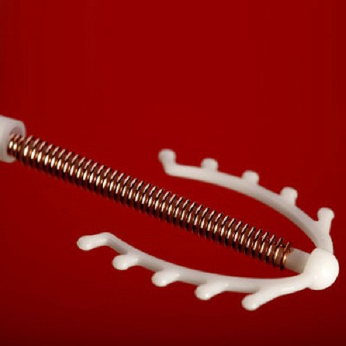 Vòng tránh thai IUD không an toàn cho thanh thiếu niên? Vòng tránh thai IUD được đưa vào trong tử cung và có tác dụng ngừa thai trong 5-10 năm. Có thể bạn đã nghe về việc IUD làm vô sinh và tăng nguy cơ viêm nhiễm vùng chậu ở phụ nữ dưới 18 tuổi nhưng điều này chỉ đúng với vòng tránh thai IUD Dalkon Shield những năm 1970. Còn vòng IUD ngày nay hoàn toàn an toàn dù bạn có con hay chưa.