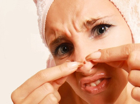 Mụn mọc trên mũi. Theo các chuyên gia sức khỏe, phản ứng chống lại stress của bạn hay gặp nhất là nổi một loạt mụn ở vùng chữ T trên mặt. Khi căng thẳng, cơ thể bạn giải phóng adrenaline - chất có thể làm tăng việc sản xuất dầu và tăng khả năng mọc mụn.