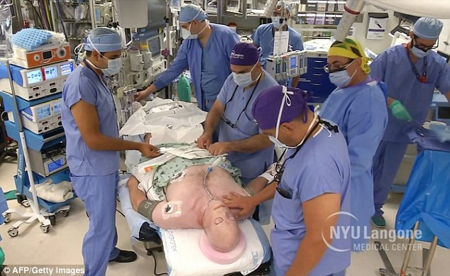 Ca ghép mặt cho Hardison diễn ra trong 26 tiếng đồng hồ.