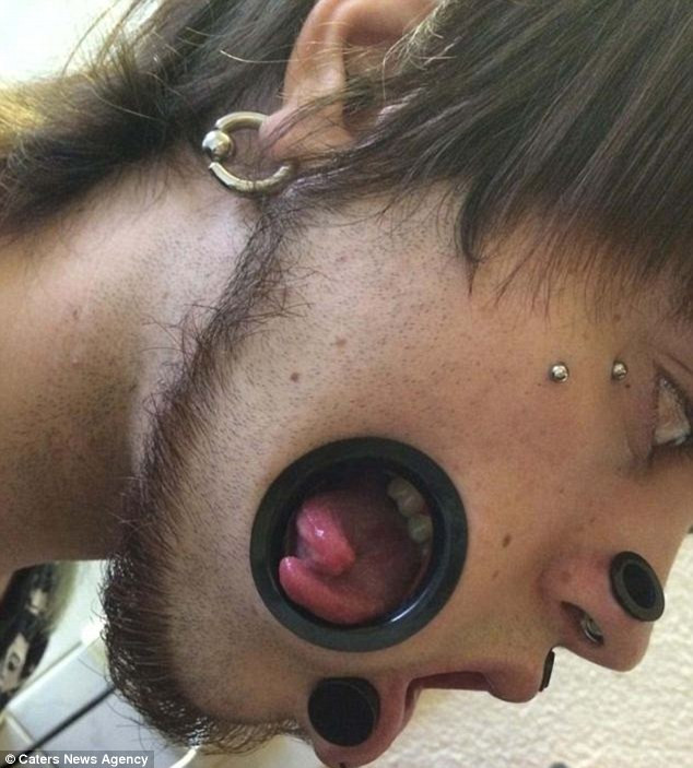 Từ những lỗ hổng lớn ở hai bên má, người ta có thể nhìn thấy răng của Miggler.