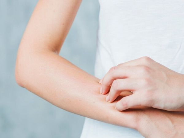 Gãi ngứa da: Thời tiết nóng của mùa hè có thể gây ra ngứa và mẩn đỏ trên da. Nhiều người có thói quen gãi để giảm ngứa nhưng điều này có thể gây ngứa nhiều hơn. Cách tốt nhất là giữ ẩm cho da. Bạn cần thoa kem dưỡng ẩm hàng ngày không chỉ cho da mặt mà còn cho cả da toàn thân sau khi tắm. Tránh dùng nước ấm sẽ khiến da bị ngứa.