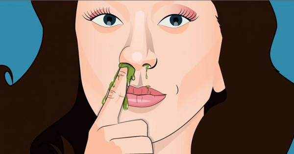 Bên cạnh đó, niêm mạc mũi rất nhạy cảm, móng tay có thể làm xước da. Có vết thương, tình trạng viêm nhiễm khoang mũi càng tăng cao, dẫn đến nguy cơ teo niêm mạc mũi, viêm xoang, viêm phế quản... (Ảnh minh họa)