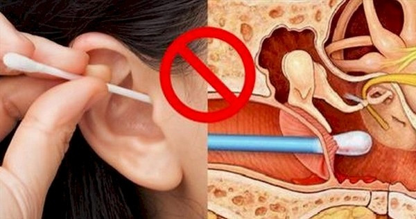 Nhiều người có thói quen ngoáy ráy song việc này không thực sự cần thiết. Bản thân tai có khả năng tự làm sạch. Hoạt động ăn, nói, ngáp, thực hiện cử động của khớp hàm dưới hoặc thay đổi tư thế đều có thể khiến ráy tự thải ra ngoài. (Ảnh: Sohu)