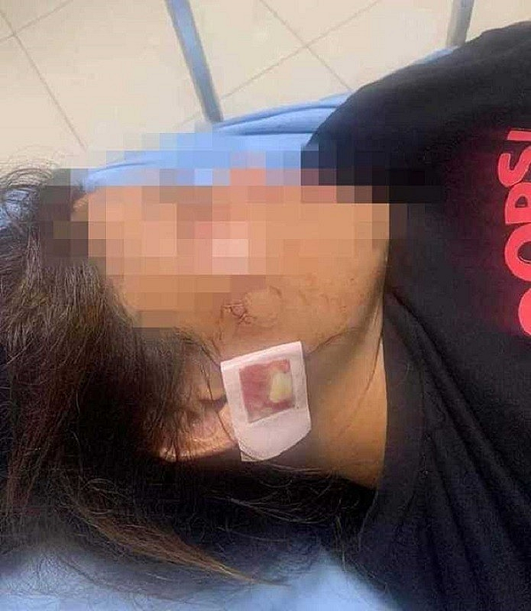 Công an vào cuộc vụ nổ súng do va chạm giao thông: Mới đây, Công an huyện Hậu Lộc, tỉnh Thanh Hóa đang vào cuộc điều tra vụ nổ súng xảy ra vào đêm 2/8 tại xã Hòa Lộc. Trước đó, vào tối ngày 2/8, anh H. (SN 1977) và anh M. đều trú xã Hoà Lộc, huyện Hậu Lộc, tỉnh Thanh Hóa đang đi trên đường thì xảy ra mâu thuẫn. Trong lúc xô xát thì bất ngờ có tiếng súng nổ vang lên. Thời điểm này vợ anh M. bị thương. Hiện cơ quan chức năng đang điều tra nguyên nhân vụ việc.